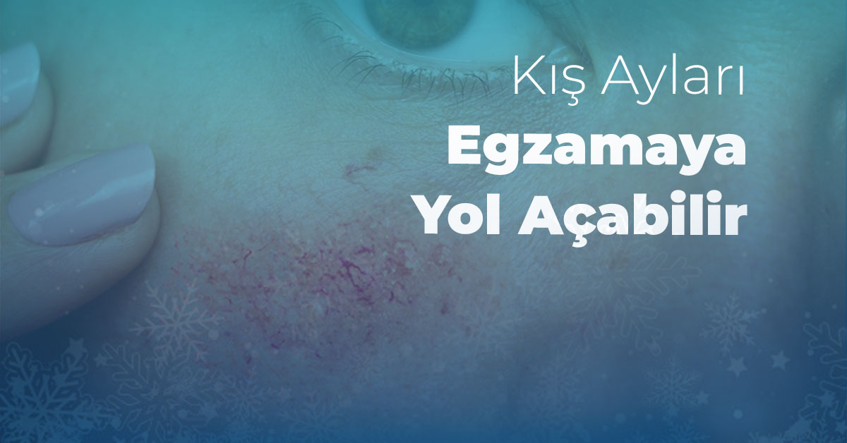 Kış Ayları Egzamaya Yol Açabilir