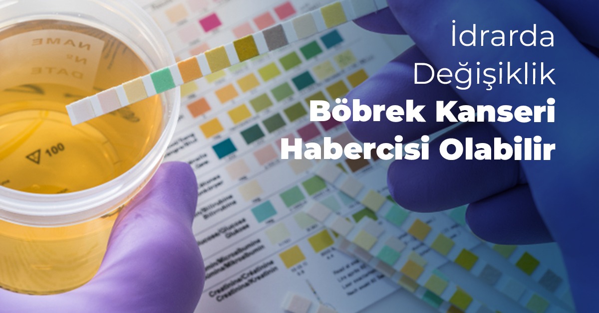 İdrarda Değişiklik Böbrek Kanseri Habercisi Olabilir