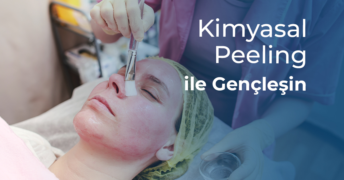 Kimyasal Peeling ile Gençlisin